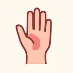 Recomendaciones artritis Reumatoide icon artritis psoria